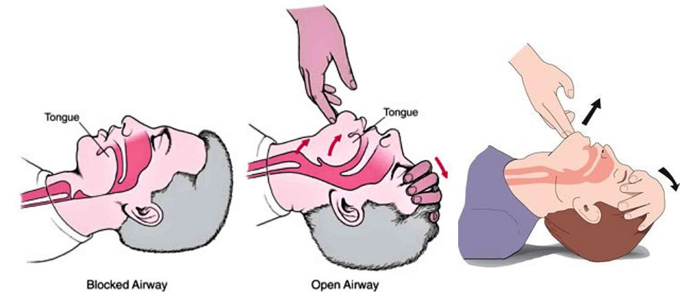 Emergency CPR Help