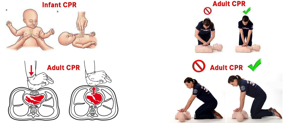 Emergency CPR Help